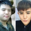 외모 탓 따돌림에 실연까지…SNS 인기남 성형 전과 후 화제