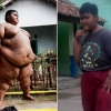 세계에서 가장 뚱뚱한 190kg 소년의 다이어트 성공기