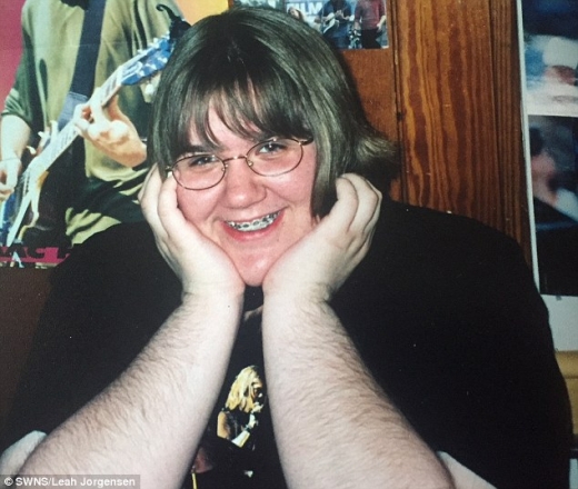 레아 요르겐센은 자신의 털을 놀리는 친구들 때문에 인생을 비관적으로 받아들였다.