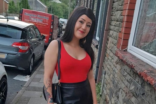 전신 탈모로 가발을 쓰고 외출한 영국의 22세 여성 에이미 치닉