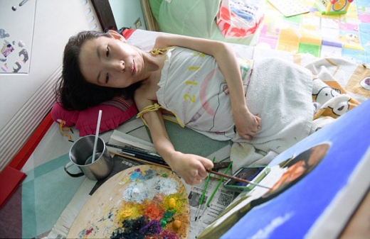 장씨는 자신이 마비됐을 뿐 죽지 않았는데, 주위의 걱정과 어머니의 눈물을 지켜보는게 더 가슴 아팠다고.