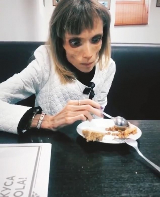 과일 외에 다른 음식 먹기를 시도하고 있다.