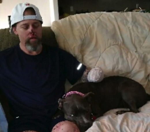 사지 절단수술을 마치고 집으로 돌아온 주인과 그를 반기는 반려견