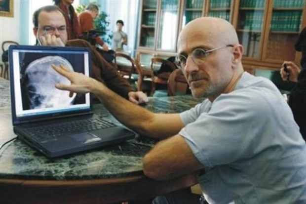 세르지오 카나베로 박사