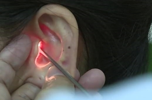 중국 여성 ‘첸’이 이비인후과에서 진료를 받고 있다.