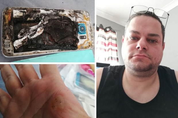 영국 사용자의 손안에서 갑자기 폭발을 일으킨 삼성전자 갤럭시S6