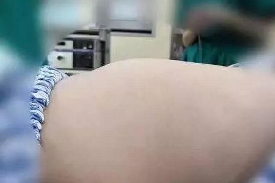 병원으로 실려온 소녀의 배가 불룩하게 솟아있다