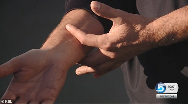 사고 당일 현장에 출동한 한 구급대원은 “아이는 손과 5~7.6㎝가량의 팔을 잃었다”고 말했다.(사진=KSL)