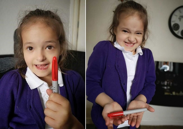 릴리는 빨간 펜(사진)으로 자기 몸 곳곳에 수두 자국을 그려 넣었다.