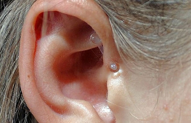 ‘다이스 피어싱’을 한 바비메이의 모습. 보석과는 다소 거리가 있어 보인다