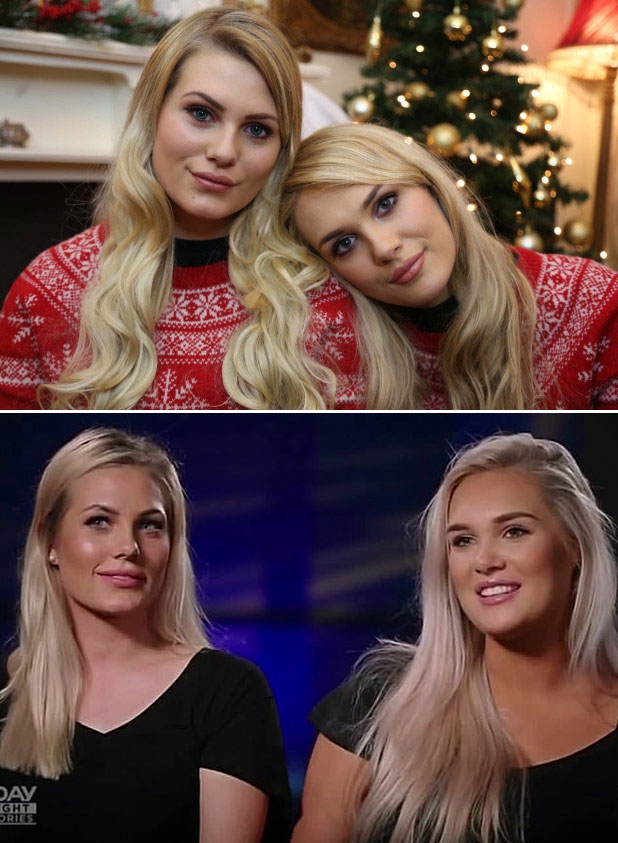 4년 전 도플갱어 미녀로 화제를 모았던 섀넌 로너건(왼쪽)과 사라 노르드스트룀의 모습. 두 미녀는 호주 방송 출연을 위해 다시 만났다. 아래 사진에서는 왼쪽이 섀넌 로너건, 오른쪽이 사라 노르드스트룀이다.(사진=트윈스트레인저스닷컴, 뉴스세븐)