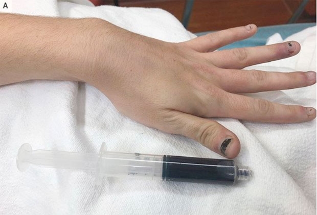 사진=뉴 잉글랜드 저널 오브 메디슨