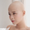 [여기는 베트남] 민머리로 미인대회 참여한 19세 여성 암환우