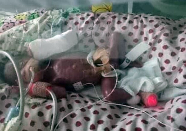 사진=엠마 헛친스 페이스북