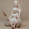 새하얀 피부와 속눈썹…편견 딛고 일어선 ‘알비노 자매 모델’