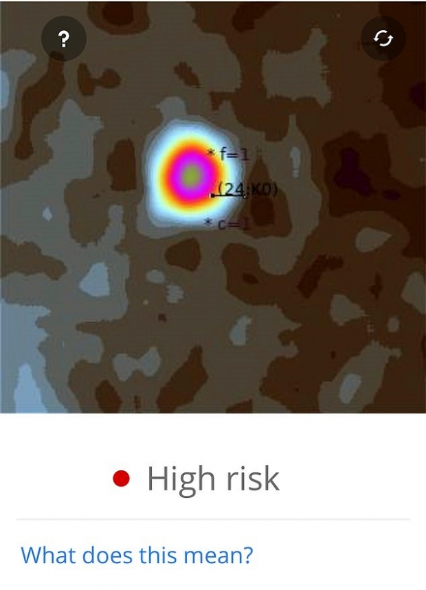 스마트폰 애플리케이션이 진단한 영국 남성의 붉은 점 상태