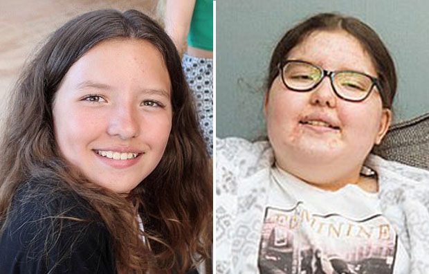 투병 전 건강했던 릴리의 모습(왼쪽)과 투병 중 릴리의 모습(오른쪽).