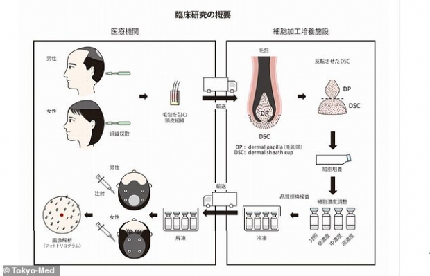 자가 모발세포 배양 이식술 과정(사진=도쿄의대 제공)