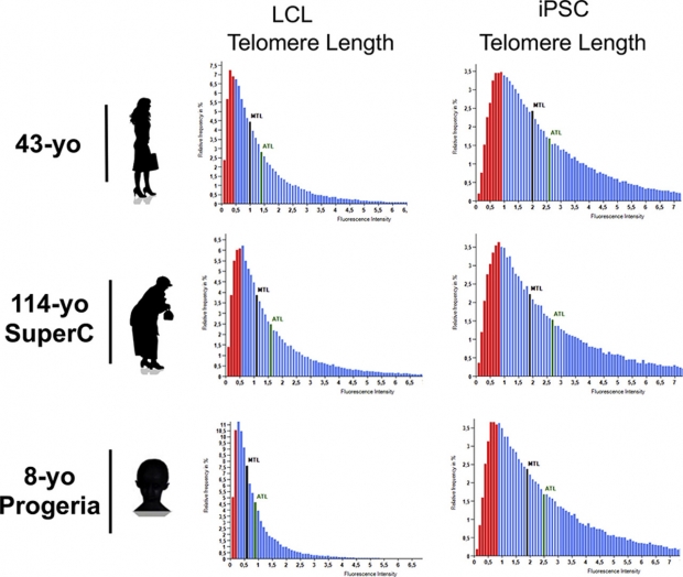 연구진은 114세 여성뿐만 아니라 건강한 43세 참가자와 이른바 조로증으로 불리는 급속한 노화를 유발하는 질병이 있는 8세 어린이 환자의 세포도 재프로그래밍하는 데 성공했다.(사진=생물화학·생물물리학연구학회지)