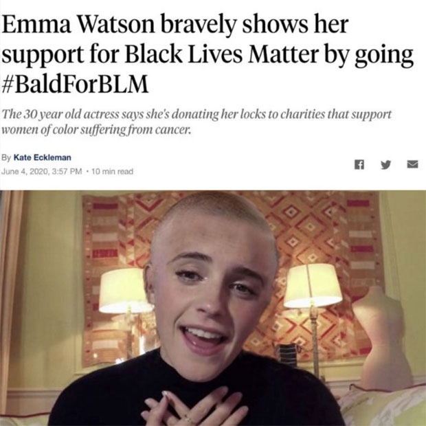 영국 유명 여배우 엠마 왓슨이 삭발을 감행했다는 ABC뉴스의 기사도 확산했다.