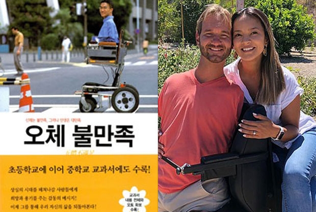 테트라 아멜리아 증후군을 가지고서도 생존한 대표적 사례로는 ‘오체불만족’으로 유명한 일본 작가 오토다케 히로타다와, 베스트셀러 작가이자 유명 강연자 닉 부이치치를 꼽을 수 있다.