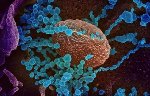 코로나19 전자현미경 이미지./사진=EPA 연합뉴스, 미국국립보건원(NIH) 제공