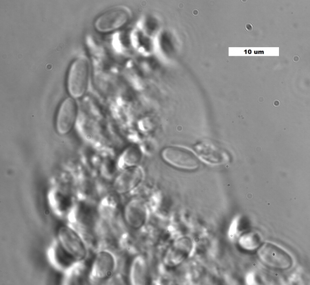 노제마(Nosema ceranae) 기생충을 확대한 모습
