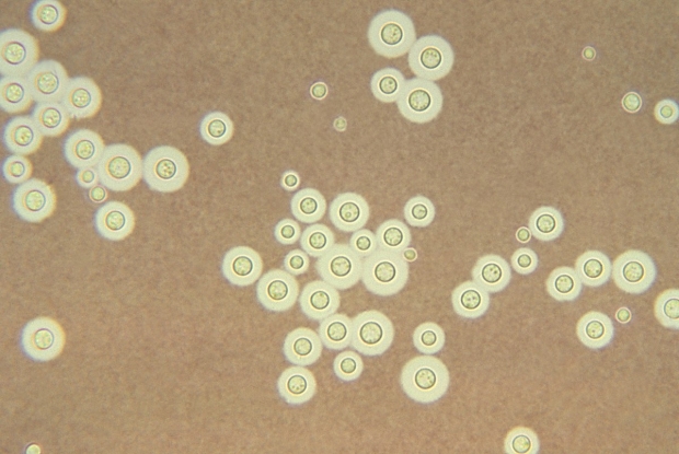 크립토코쿠스 네오포만스(사진=CDC/Dr. Leanor Haley / Public domain)