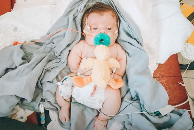 27일(현지시간) ABC방송 굿모닝아메리카(GMA)는 미국 캔자스주에 사는 한 아기가 선천성 기형에도 불구하고 강인한 생명력을 보여주고 있다고 전했다./사진=애비 스토리 인스타그램