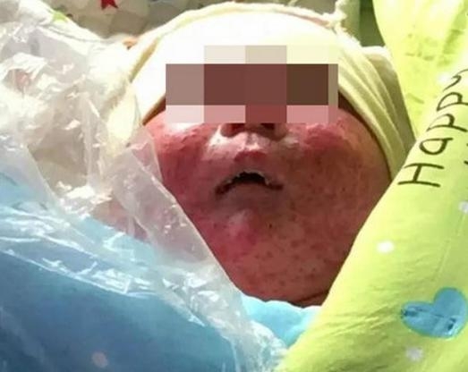 구조된 A군은 출생 이후 오랜 시간 동안 외부에 방치되면서 각종 피부병과 호흡기 질환 등의 질병에 감염된 상태였다.