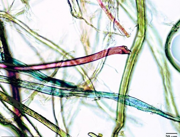 인체 내에서 발견되는 미세한 플라스틱을 확대한 모습(자료사진)