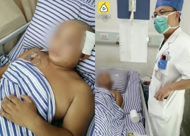 수술 후 회복 중인 중국 23세 천 씨 수술 후 회복 중인 중국 23세 천 씨