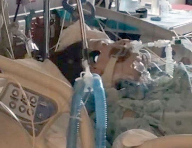 두 달여간 병상에서 바이러스와 사투를 벌였지만 뇌출혈 등 합병증으로 지난달 19일 결국 세상을 떠났다./사진=페이스북