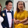 35세 연하남과 결혼한 베트남 60대 여성, 어려 보이려 성형수술 했다가