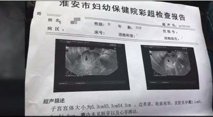 교장 진 씨와 사이에 임신 사실을 입증하는 자료