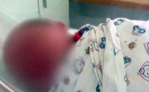 부검 결과 아기에게서 갈비뼈 골절과 간, 비장, 복부 대동맥 파열이 관찰됐다. 사인은 외상 후 심장마비로 밝혀졌다. 검찰은 베테랑 경찰로 오랫동안 심폐소생술 훈련을 받은 그가 심폐소생술을 잘못했다는 건 어불성설이라고 지적했다. 더군다가 아기에게서 관찰된 장기 파열은 폭행이 아니고서는 설명할 수 없는 수준이라고 꼬집었다.