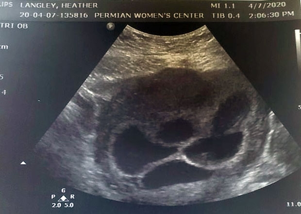 랭리는 “임신 6주째 다섯쌍둥이라는 걸 알았다. 두려웠다. 한꺼번에 5명을 어떻게 키우나 싶어 걱정이 앞섰다. 이름 고르기조차 벅찼다”고 말했다.