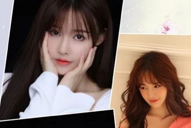 가오 씨의 수술 전 모습