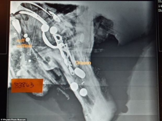 퇴적물 속 유골을 엑스선으로 촬영한 이미지.