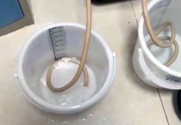 뤼씨는 “호텔은 객실마다 생수 2병을 무료로 제공했는데, 장모가 마신 생수는 한 모금만 마셔도 역한 냄새가 올라왔다. 문제의 생수를 다시 확인하려 했지만 이미 폐기된 상황이었다. 경찰을 불렀는데 CCTV가 고장이 나 누가 생수를 버렸는지 알 수 없었다”고 말했다.