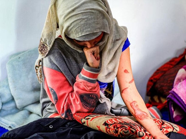 사건 이후 셰리안은 고소 절차를 밟았으나 전 남편은 이미 잠적한 뒤였다. 그녀는 “경찰과 법원의 적절한 처벌을 바란다. 내 젊음과 학업, 내 일을 되찾고 싶다. 내 삶을 되찾고 싶다”고 절규했다.