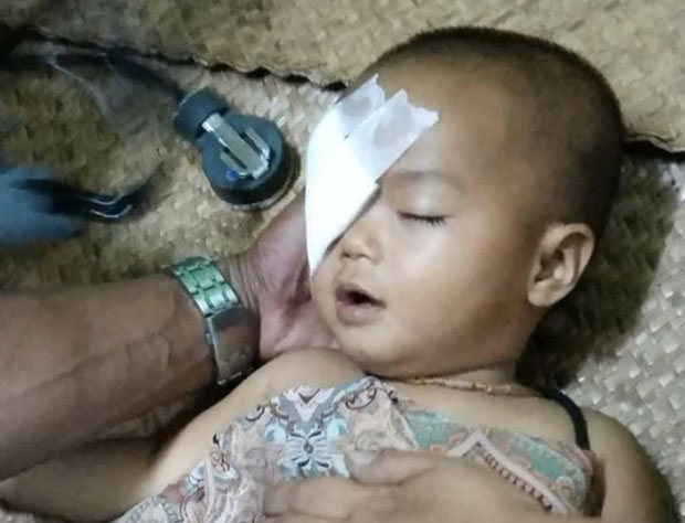 미얀마 나우는 네인 사망 당일 양곤과 만달레이, 사가잉 등 미얀마 전역에서 150명 이상이 군경 총에 맞아 사망한 것으로 집계했다. 만달레이에서는 집에 있던 13살 소녀가 총에 맞아 숨졌다. 고무탄에 눈을 맞아 다친 1살 아기도 있다.