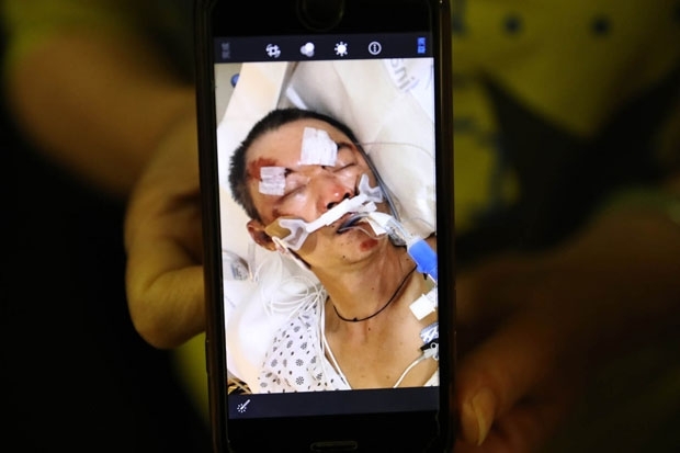 뇌출혈과 안면 골절상 등 심각한 부상이 확인된 마씨는 빠른 회복을 위해 유도된 혼수상태로 치료에 들어갔다. 하지만 상태는 여전히 위독하다.