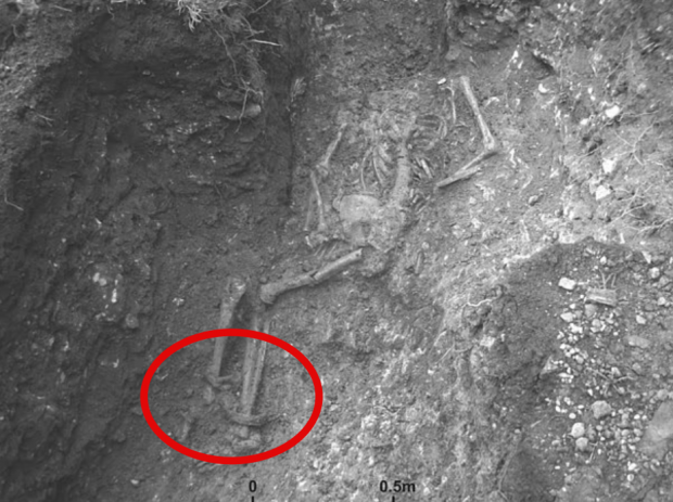 고대 로마가 영국을 침략했을 당시인 1600~1800년 전, 노예의 존재를 입증하는 유골이 발견됐다. 사진은 발목에 족쇄를 차고 있는 유골의 모습.