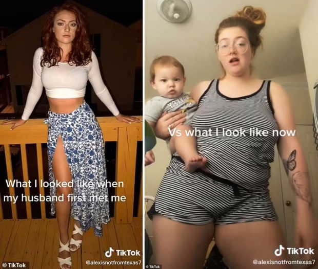 틱톡 이용자 렉시 험프리스(사진)도 자신의 비포 애프터 영상을 게시했고 그녀가 변한 모습에 많은 사람이 주목하면서 조회 수는 320만 회를 넘어섰다.