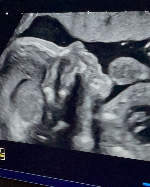 12일에는 첫 아이 임신 소식도 전했다. 올리베이라는 “특별한 친구와 인생을 함께 꾸려나가게 됐다”면서 어서 아이와 만나고 싶다는 바람을 드러냈다./사진=미겔 올리베이라 인스타그램