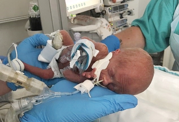 태어난 지 2주 된 체스터의 모습.