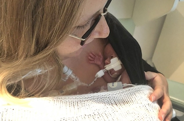 출산 직후 확인한 체스터 상태는 더욱 심각했다. 심장에서는 구멍이 발견됐고, 결장 부위에서는 신생아괴사성장염이 관찰됐다. 형 오티스는 태어난 지 6주 만에 퇴원했지만 체스터는 계속 병원에 남아 집중치료를 받아야 했다.