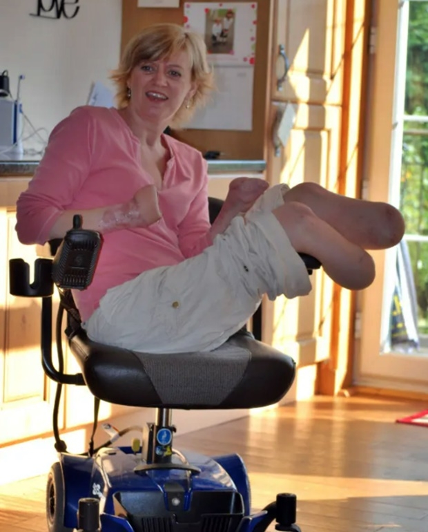 허튼은 2013년 갑작스러운 패혈증으로 손과 다리를 모두 잃었다. 졸지에 사지절단환자가 된 후 그의 삶은 180도 달라졌다.