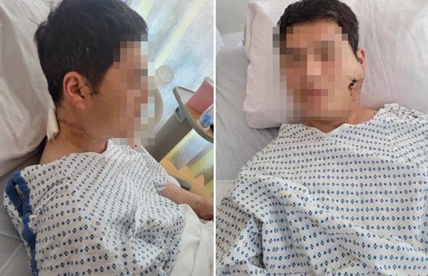 괴한 공격으로 피해자는 중상을 입고 병원으로 옮겨졌다. 피해자는 병원에서 목덜미 12바늘, 왼쪽 귀밑에서부터 뺨까지 14바늘 등 최소 30바늘을 꿰맸다.